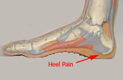 Heel pain is an indicator that something’s wrong.